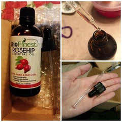 BioFinest Rosehip Oil - 100% Pure Cold-Pressed - Certified Organic - Chile Premium Rosehip Seed Oil - BEST Moisturizer for Face, Nails, Dry Hair & Skin - FREE Glass Dropper - 100ml (3.4 fl.Oz)